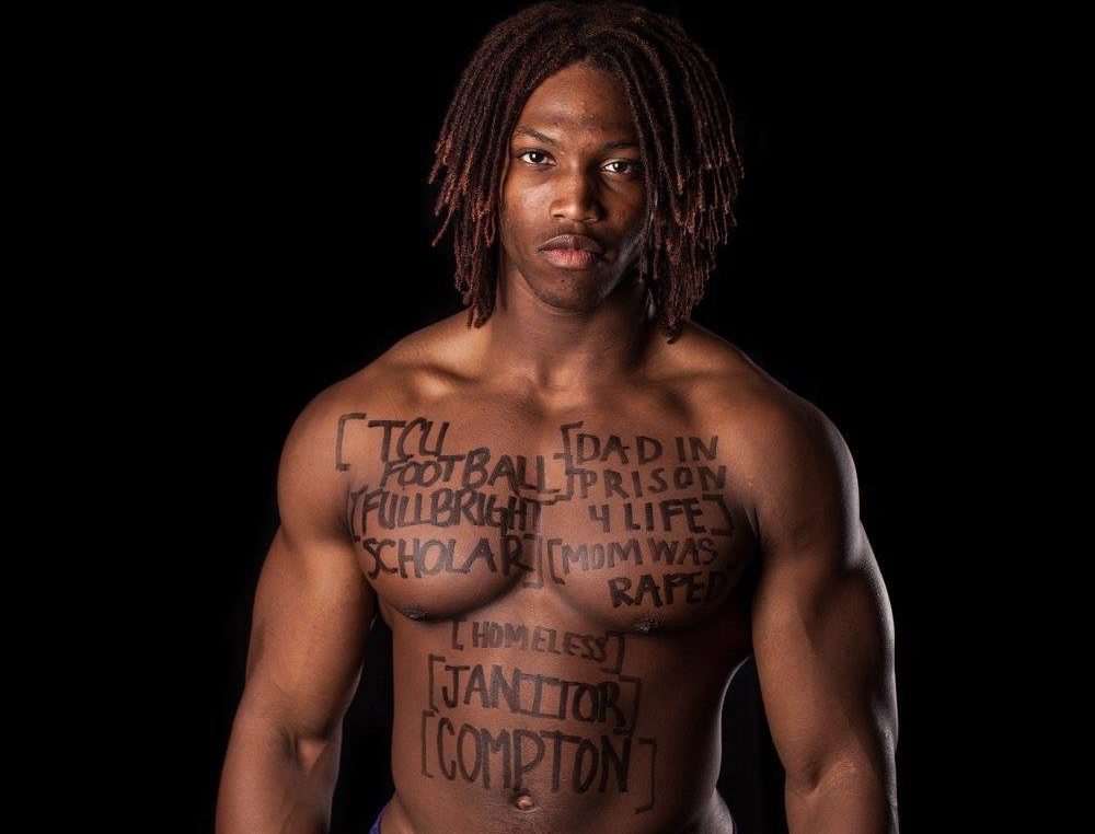 Caylin Moore during the Dear World campaign. He writes about his past experiences on his skin.
